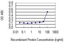 TFDP2 / DP2 Antibody (clone 2E6)