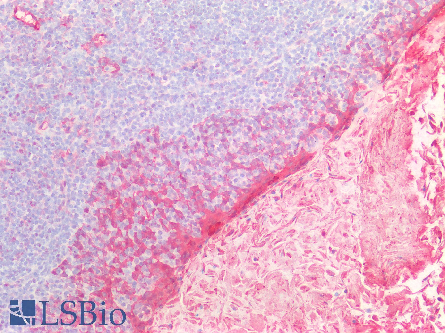IHC-plus™ HSPB1 / HSP27 Antibody