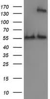 CAT / Catalase Antibody (clone OTI1B8)
