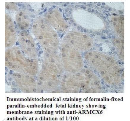 Polyclonal Rabbit anti-Human ARMCX6 Antibody (aa100-278, IHC)