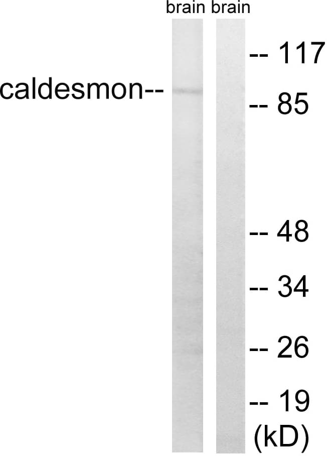 CALD1 / Caldesmon Antibody (aa725-774)