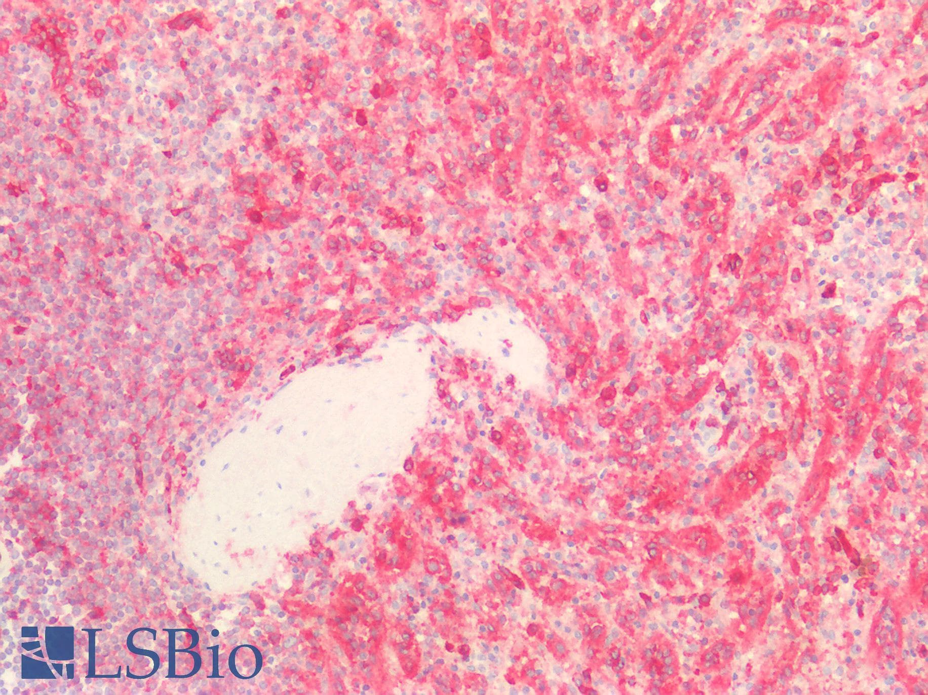IHC-plus™ PECAM-1 / CD31 Antibody (C-Terminus)