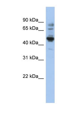 PRAME Antibody (aa71-120)