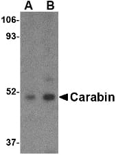 TBC1D10C / CARABIN Antibody