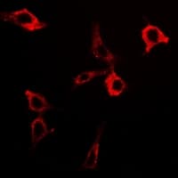 Polyclonal Rabbit anti-Human DLAT / PDC-E2 Antibody (IF, WB)