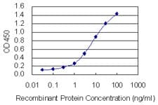 CALU / Calumenin Antibody (clone 6C8)