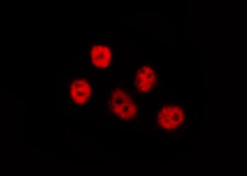LIMK1 / LIMK Antibody (phospho-Thr508,pThr505)