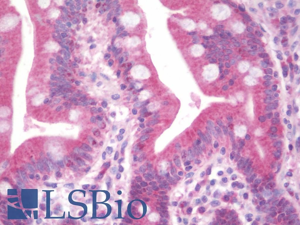 IHC-plus™ DIMT1L Antibody (aa268-298)