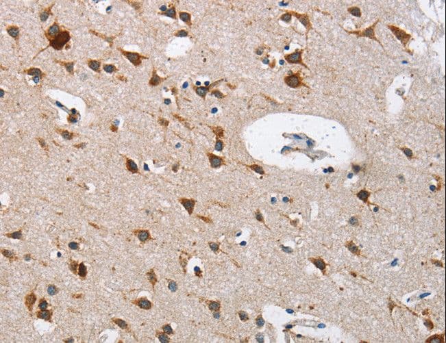 Polyclonal Rabbit anti-Human CTSL / Cathepsin L Antibody (IHC, WB)
