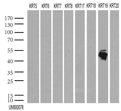 KRT19 / CK19 / Cytokeratin 19 Antibody (aa240-390, clone UMAB186)