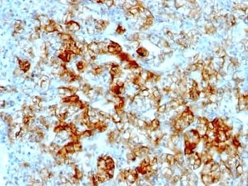 CDH16 / Cadherin 16 Antibody (clone SPM594, Azide-free, BSA-free)