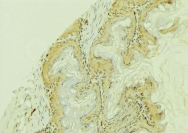 CYP4F12 Antibody