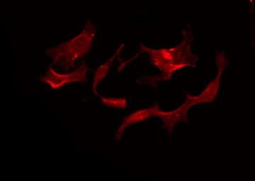 Polyclonal Rabbit anti-Human GPR119 Antibody (IF, WB)