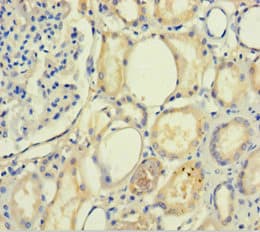 PLA2R / PLA2R1 Antibody (aa395-530)