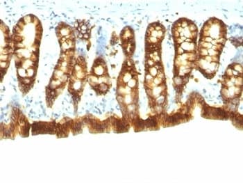 EPCAM Antibody (clone Epcam/1158)