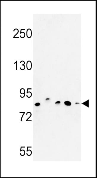 CHPF / CHSY2 Antibody (aa327-354)