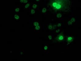 RPS6KB1 / P70S6K / S6K Antibody (clone OTI4G4)