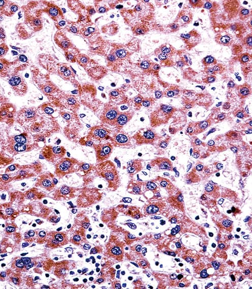 CYP2C9 / Cytochrome P450 2C9 Antibody (aa82-110)