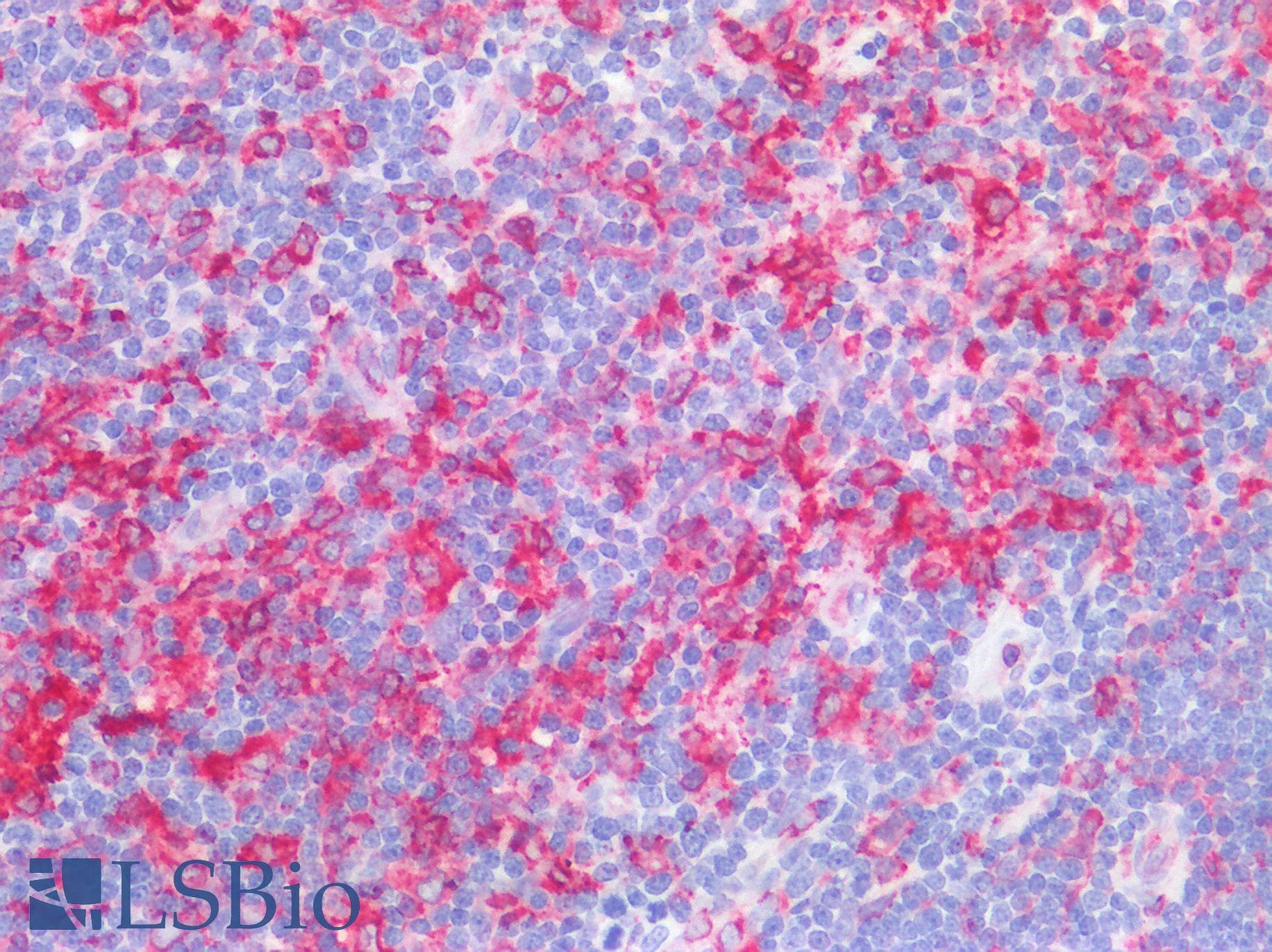 IHC-plus™ Monoclonal Mouse anti-Human CD74 / CLIP Antibody (clone CDLA74-1, Azide-free,BSA-free, IHC, IF)