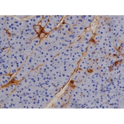 Polyclonal Rabbit anti-Human STAT1 Antibody (phospho-Tyr701, IHC, IF, WB)