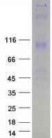 Human WFS1 Protein (Recombinant Myc-DDK (Flag))