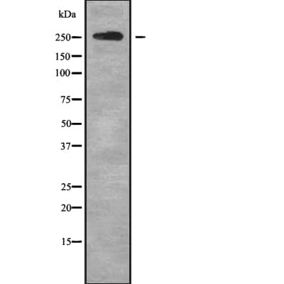 ABCA4 Antibody