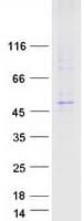 Human LMBR1 Protein (Recombinant Myc-DDK (Flag))