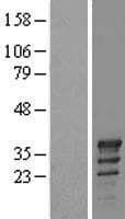 TSPY2 Protein (Over-Expression Lysate Myc-DDK (Flag))
