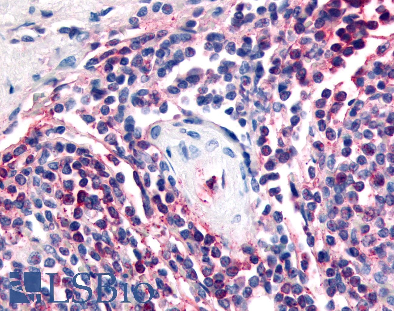IHC-plus™ ATRN / Attractin Antibody (Internal)