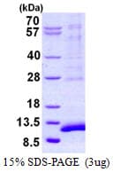 Human SYCE3 Protein (Recombinant His)
