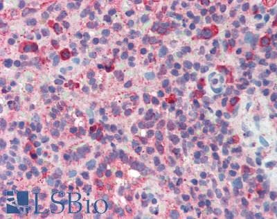 Polyclonal Rabbit anti-Mouse EPO / Erythropoietin Antibody (aa82-192, IHC, WB)