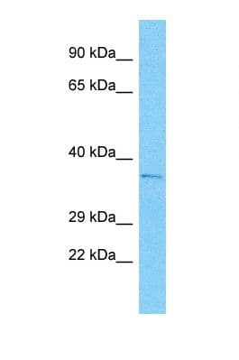 Polyclonal Rabbit anti-Human JCG1 / OR5P3 Antibody (aa221-270, WB)