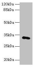Polyclonal Rabbit anti-Human FAM78A Antibody (IHC, WB)