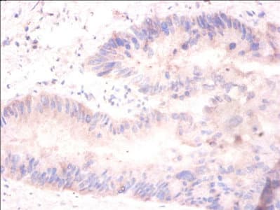 H2AFJ Antibody