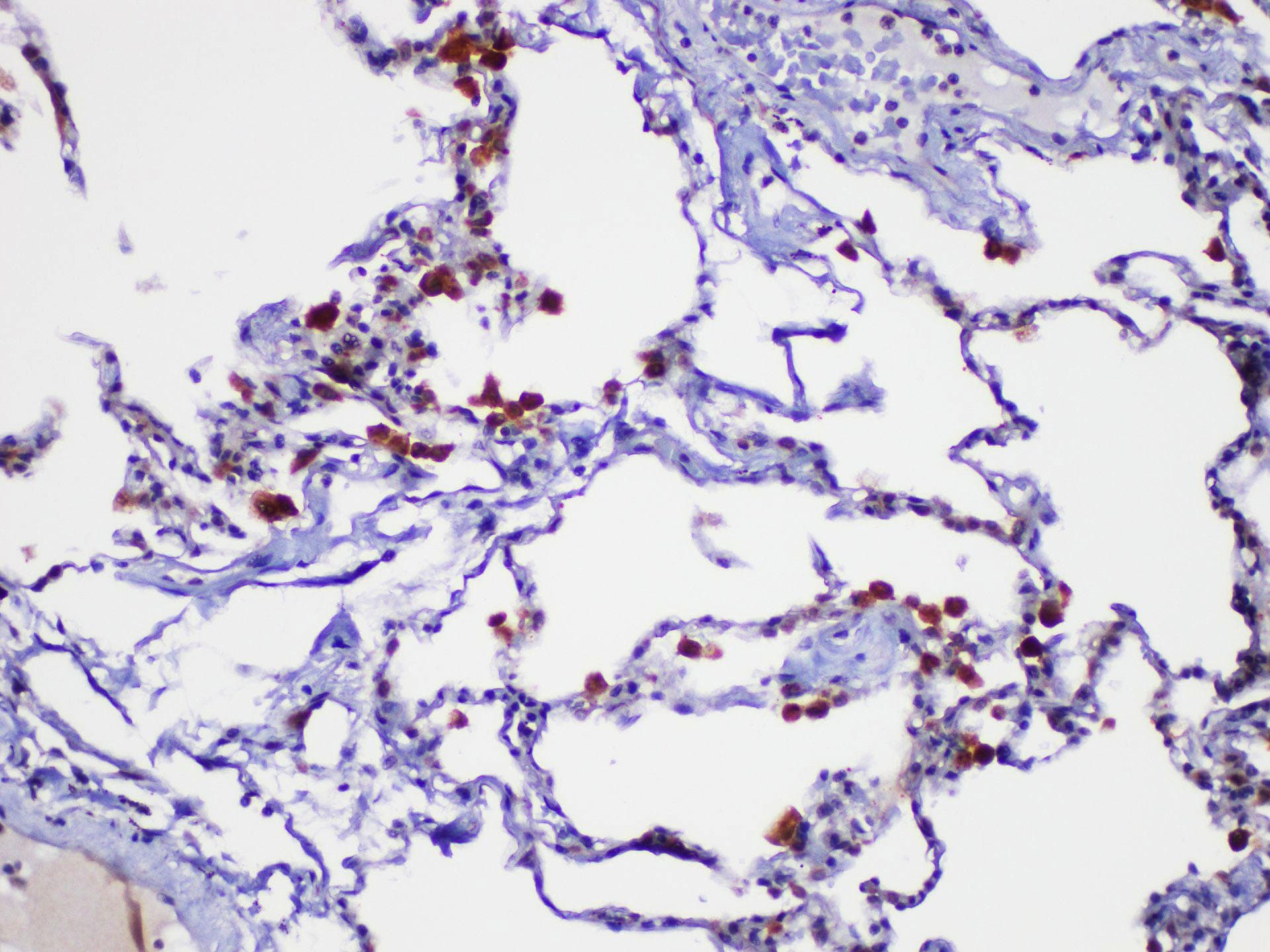 LGALS3 / Galectin 3 Antibody