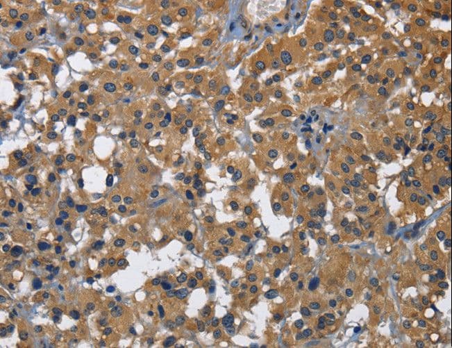 Polyclonal Rabbit anti-Human NK1 / CD160 Antibody (IHC, WB)