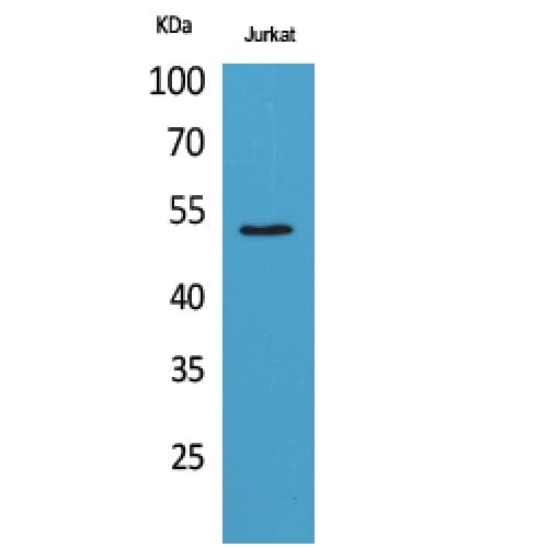 Polyclonal Rabbit anti-Human Alpha Tubulin Antibody (IHC, WB)