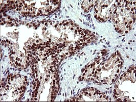 UPRT Antibody (clone OTI1A3)