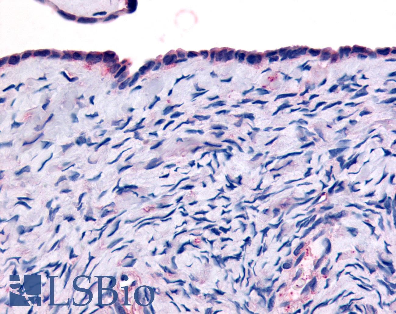 IHC-plus™ THRA / THR Alpha Antibody (Ligand-binding Domain)