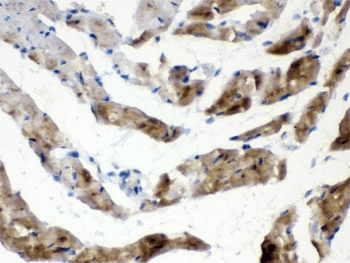 FABP3 / H-FABP Antibody (aa119-133)