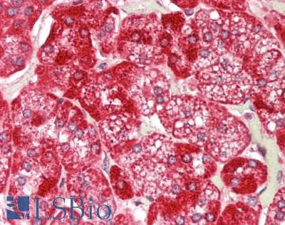 IHC-plus™ Polyclonal Rabbit anti-Human TOMM20 Antibody (IHC, IF, WB)