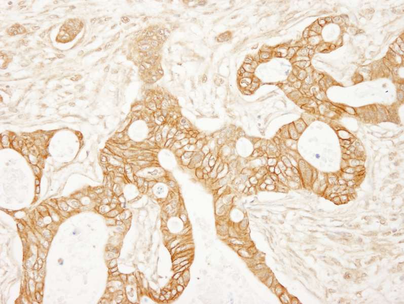 Polyclonal Rabbit anti-Human CTNNB1 / Beta Catenin Antibody (aa710-760, IHC, WB)