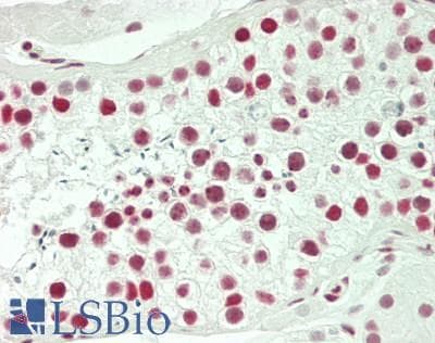 IHC-plus™ Polyclonal Rabbit anti-Human TRIM28 / KAP1 Antibody (aa1-50, IHC, IF)