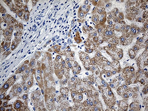 Monoclonal Mouse anti-Human CBR4 Antibody (clone OTI3C10, IHC)