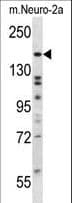 Polyclonal Rabbit anti-Human ATG2B Antibody (aa118-146, WB)