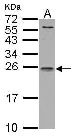 IL1RN Antibody (aa1-177)
