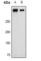 PathPlus™ CSPG4 / NG2 Antibody