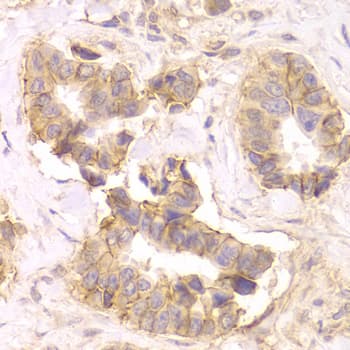 CTNND1 / p120 Catenin Antibody