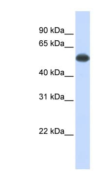 PPP3CA / CCN1 / Calcineurin A Antibody (aa432-481)