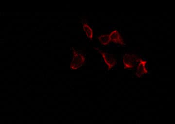 ER Alpha / Estrogen Receptor Antibody (phospho-Ser106)